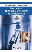 Step by Step: High Tibial Osteotomy by Hemicallotasis