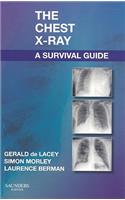 The Chest X-Ray: A Survival Guide