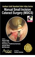 Manual Small Incision Cataract Surgery (Msics)