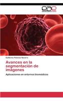 Avances en la segmentación de imágenes