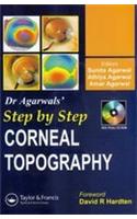 Step by Step Corneal Topography