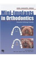 Mini-Implants in Orthodontics