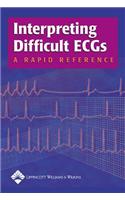 Interpreting Difficult ECGs