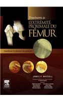 Fractures de l'Extrémité Proximale Du Fémur