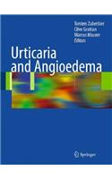 Urticaria and Angioedema