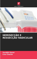 Hemisecção E Ressecção Radicular