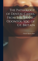 Pathology of Dental Caries. From the 'trans.', Odontol. Soc. of Gt. Britain