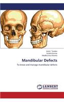 Mandibular Defects