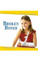Broken Bones
