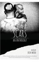 Scars