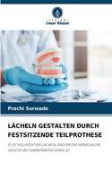 Lächeln Gestalten Durch Festsitzende Teilprothese