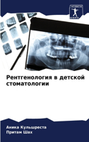 Рентгенология в детской стоматологии