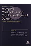 Rehabilitation of Complex Cleft Palate and Craniomaxiliofacial Effects: The Challenge of Bauru