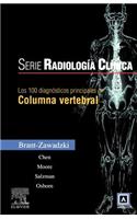 Los 100 Diagnosticos Principales En Columna Vertebral