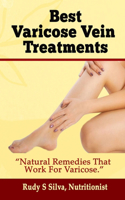 Best Varicose Vein Treatments