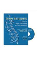 Spinal Deformity