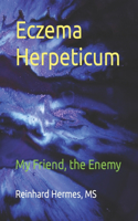 Eczema Herpeticum: My Friend, the Enemy