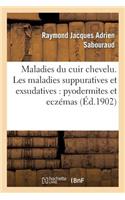 Maladies Du Cuir Chevelu. Les Maladies Suppuratives Et Exsudatives: Pyodermites Et Eczémas