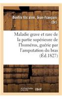 Description Succincte d'Une Maladie Grave Et Rare de la Partie Supérieure de l'Humérus: Guérie Par l'Amputation Du Bras