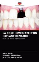 Pose Immédiate d'Un Implant Dentaire