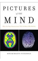 Pictures of the Mind