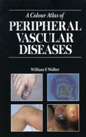 A Colour Atlas of Peripheral Vascular Diseases
