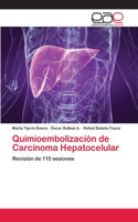 Quimioembolización de Carcinoma Hepatocelular