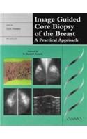 Image Guided Core Biopsy of the Breast
