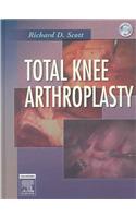 Total Knee Arthroplasty