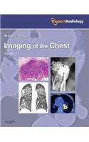 Imaging of the Chest, 2-Volume Set