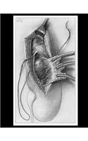 Suspension of the Kidney Notebook