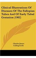 Clinical Illustrations Of Diseases Of The Fallopian Tubes And Of Early Tubal Gestation (1902)