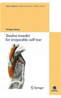 Tendon transfer for irreparable cuff tear