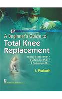 A Beginner's Guide to Total Knee Replacement