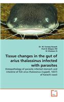 Tissue changes in the gut of arius thalassinus infected with parasites