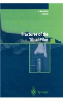 Fractures of the Tibial Pilon