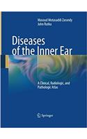 Diseases of the Inner Ear