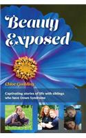 Beauty Exposed