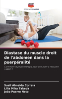 Diastase du muscle droit de l'abdomen dans la puerpéralité