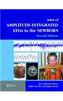 An Atlas of Amplitude-Integrated EEGs in the Newborn