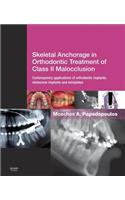 Skeletal Anchorage in Orthodontic Treatment of Class II Malocclusion