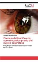 Facoemulsificación con core mecánico previo del núcleo cataratoso