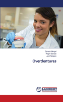 Overdentures
