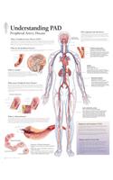 Understanding PAD Paper Poster