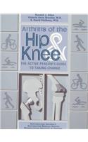 Arthritis of the Hip & Knee: The Active Person's Guide to Taking Charge