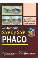 Step by Step Phacoemulsification