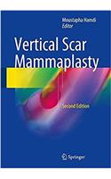 Vertical Scar Mammaplasty