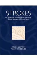 Strokes