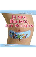 Bumps, Bruises, and Scrapes