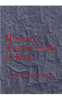 Human Tumor Cells in Vitro